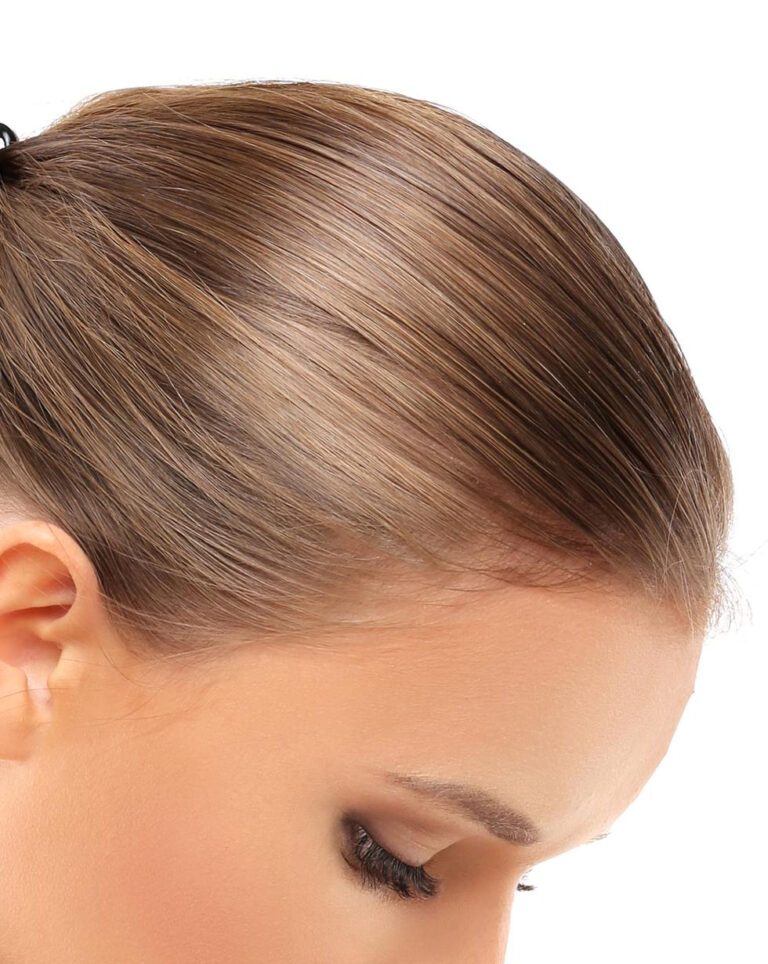 przerzedzenie-wlosow-i-wypadanie-wlosow-lysienie-typu-zenskiego-przeszczep-wlosow — kopia